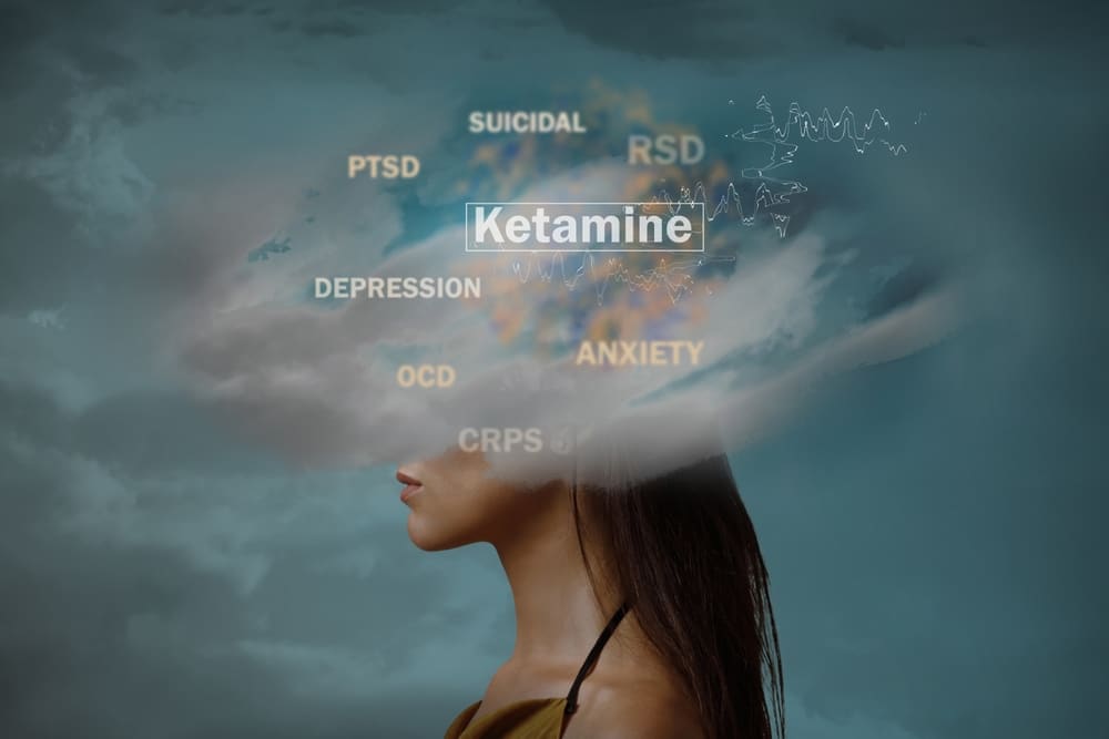 Ketamine Therapy